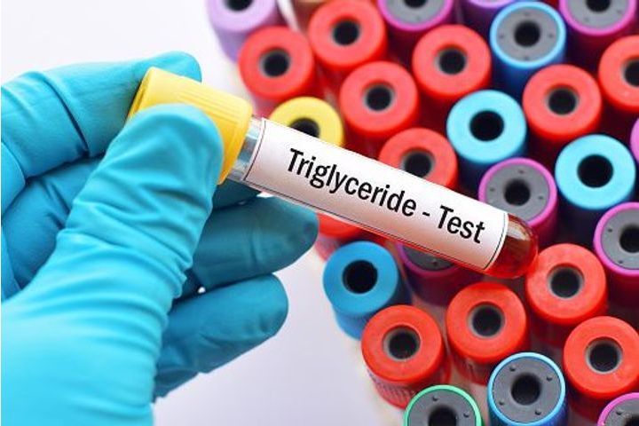 triglycerides test